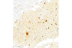Immunohistochemistry of paraffin embedded rat spinal cord using FGF11 (ABIN7073941) at dilution of 1:2200 (400x lens) (FGF11 抗体)