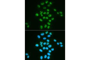 Immunofluorescence analysis of HeLa cell using BMI1 antibody.