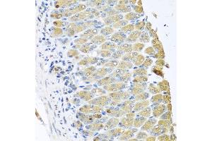 Immunohistochemistry (IHC) image for anti-Opioid Growth Factor Receptor (OGFR) (AA 1-280) antibody (ABIN6145006)