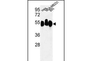 Western blot analysis of RBBP7 Antibody (N-term) (ABIN652773 and ABIN2842509) in Hela, MDA-M, 293 cell line lysates (35 μg/lane). (RBBP7 抗体  (N-Term))