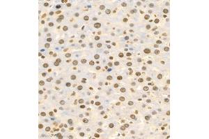 Immunohistochemistry (Paraffin-embedded Sections) (IHC (p)) image for anti-Bromodomain PHD Finger Transcription Factor (BPTF) antibody (ABIN7073234)