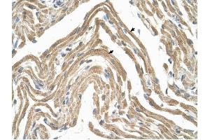 CCBP2 antibody was used for immunohistochemistry at a concentration of 4-8 ug/ml to stain Skeletal muscle cells (arrows) in Human Muscle. (CCBP2 抗体  (N-Term))