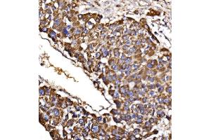 IHC analysis of MDH2 using anti-MDH2 antibody (ABIN7602618).