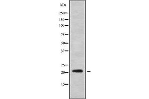 Western blot analysis of MED22 using NIH-3T3 whole cell lysates (MED22 抗体  (Internal Region))