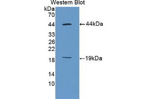 Western blot analysis of the recombinant protein. (Ki-67 抗体  (AA 2386-2674))