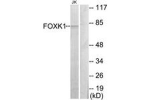 Western blot analysis of extracts from Jurkat cells, using FOXK1 Antibody. (Foxk1 抗体  (AA 681-730))