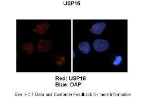 Sample Type :  Human brain stem cells (NT2)   Primary Antibody Dilution :   1:500  Secondary Antibody :  Goat anti-rabbit Alexa Fluor 594  Secondary Antibody Dilution :   1:1000  Color/Signal Descriptions :  Red: USBlue: DAPI  Gene Name :  US Submitted by :  Dr. (USP16 抗体  (N-Term))
