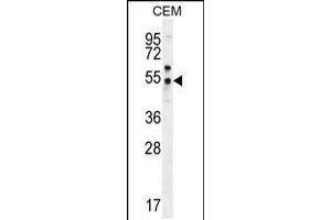 Western blot analysis in CEM cell line lysates (35ug/lane). (FOLH1B 抗体  (C-Term))