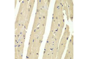 Immunohistochemistry of paraffin-embedded mouse heart using USP7 antibody (ABIN6293331) at dilution of 1:200 (40x lens). (USP7 抗体)