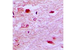 Immunohistochemical analysis of E2F6 staining in human brain formalin fixed paraffin embedded tissue section. (E2F6 抗体  (Center))