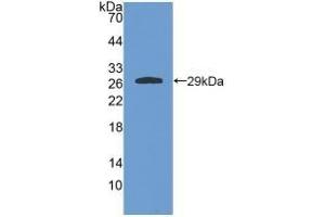 Detection of Recombinant GSTa4, Rat using Polyclonal Antibody to Glutathione S Transferase A4 (GSTA4) (GSTA4 抗体  (AA 2-222))