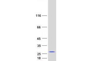 Validation with Western Blot
