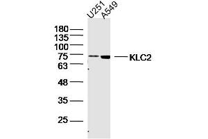 Lane 1: U251 lysates Lane 2: A549 lysates probed with KLC2 Polyclonal Antibody, Unconjugated  at 1:300 dilution and 4˚C overnight incubation. (KLC2 抗体  (AA 51-150))