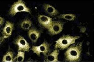Immunofluorescent staining of RSV-3T3 cells. (IRS1 抗体  (AA 1131-1234))