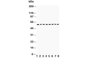 Western blot testing of Beclin 1 antibody and Lane 1:  COLO320 (Beclin 1 抗体  (AA 1-354))