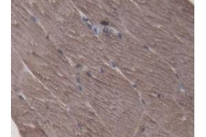 Detection of CKM in Porcine Skeletal muscle Tissue using Polyclonal Antibody to Creatine Kinase, Muscle (CKM) (CKM 抗体  (AA 11-367))