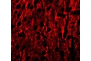 Immunofluorescence of RILPL1 in mouse brain cells with RILPL1 antibody at 20 ug/mL. (RILPL1 抗体  (N-Term))