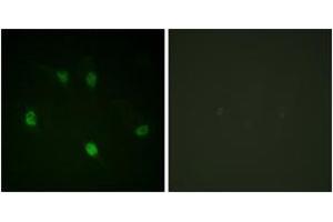 Immunofluorescence analysis of HeLa cells, using Cyclin E1 (Ab-77) Antibody. (Cyclin E1 抗体  (AA 43-92))