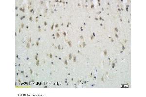 Formalin-fixed and paraffin embedded rat brain tissue labeled with Anti-LC3B/MAP LC3β/MAP1A Polyclonal Antibody, Unconjugated  followed by conjugation to the secondary antibody and DAB staining (MAP1LC3A/B 抗体  (AA 21-121))