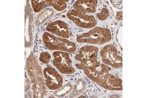 Immunohistochemical staining of human kidney with CXorf27 polyclonal antibody  shows strong cytoplasmic positivity in cells in tubules.