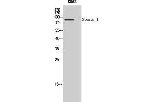 Western Blot analysis of K562 cells using Stonin-1 Polyclonal Antibody. (STON1 抗体  (AA 660-740))