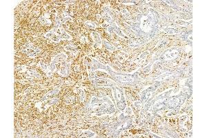 anti-Proline-Rich Coiled-Coil 2C (PRRC2C) antibody