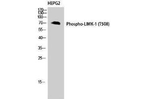 Western Blotting (WB) image for anti-LIM Domain Kinase 1 (LIMK1) (pThr508) antibody (ABIN3172924) (LIM Domain Kinase 1 抗体  (pThr508))