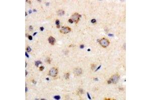 Immunohistochemical analysis of Beta-1 Adrenergic Receptor staining in human brain formalin fixed paraffin embedded tissue section.