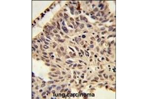 Immunohistochemistry (Paraffin-embedded Sections) (IHC (p)) image for anti-Histone Cluster 1, H4a (HIST1H4A) (2meLys20), (AA 1-30) antibody (ABIN650815)