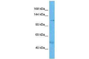 Host:  Rabbit  Target Name:  UTY  Sample Type:  Thyroid Tumor lysates  Antibody Dilution:  1. (UTY 抗体  (N-Term))