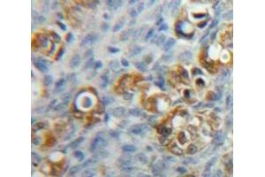 #VALUE! (F11R 抗体  (AA 64-249))
