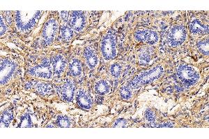 Immunohistochemistry (IHC) image for anti-Collagen, Type I, alpha 1 (COL1A1) (AA 1218-1440) antibody (ABIN7425806)