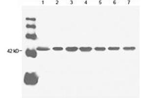 Image no. 1 for anti-Actin, beta (ACTB) antibody (ABIN2614157) (beta Actin 抗体)