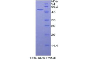 SDS-PAGE analysis of Rat Peroxiredoxin 6 Protein. (Peroxiredoxin 6 Protein (PRDX6))