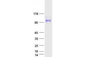Western Blotting (WB) image for Plexin Domain Containing 2 (PLXDC2) protein (Myc-DYKDDDDK Tag) (ABIN2729203)