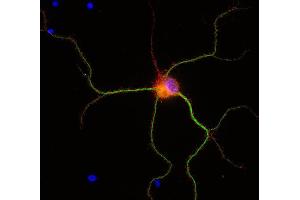 Immunofluorescence labeling of PFA fixed rat hippocampus neurons with anti-tomosyn (dilution 1 : 500; red) and mouse anti-MAP 2, (, dilution 1 : 500; green).