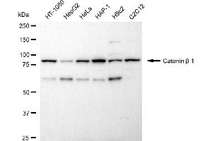 Western blotting analysis using catenin beta 1 antibody (ABIN7797930). (CTNNB1 抗体)