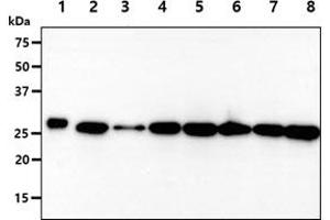 The recombinant protein (50ng) and cell lysates (40ug) were resolved by SDS-PAGE, transferred to PVDF membrane and probed with anti-human PGAM2 antibody (1:1000). (PGAM2 抗体)