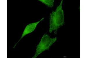 Immunofluorescence of monoclonal antibody to SEPT8 on HeLa cell. (Septin 8 抗体  (AA 1-258))