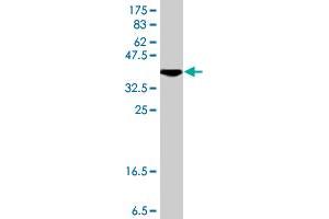 Western Blot detection against Immunogen (37. (OTX1 抗体  (AA 10-116))