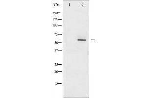 Western blot analysis of Akt2 phosphorylation expression in TNF-α treated A2780 whole cell lysates,The lane on the left is treated with the antigen-specific peptide. (AKT2 抗体  (pSer474))