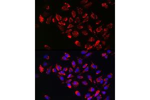 Immunofluorescence analysis of U-2 OS cells using [KO Validated] Hexokinase II Rabbit pAb (ABIN3021255, ABIN3021256, ABIN3021257 and ABIN6214088) at dilution of 1:100 (40x lens). (Hexokinase 2 抗体  (AA 1-120))