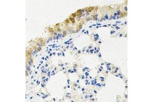 Immunohistochemical analysis of KIF2B staining in mouse lung formalin fixed paraffin embedded tissue section. (KIF2B 抗体)
