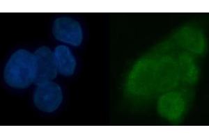 IF analysis of TRMT6 using anti-TRMT6 antibody (ABIN7602138). (TRMT6 抗体  (AA 6-489))