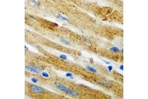 Immunohistochemical analysis of CARS staining in mouse heart formalin fixed paraffin embedded tissue section. (CARS 抗体)
