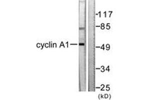 Western blot analysis of extracts from SKOV3 cells, using Cyclin A1 Antibody. (Cyclin A1 抗体  (AA 411-460))