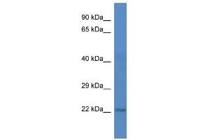 Western Blot showing 5730409E04Rik antibody used at a concentration of 1. (C1ORF216 抗体  (C-Term))