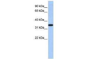 Western Blotting (WB) image for anti-ADP-Ribosyltransferase 4 (Dombrock Blood Group) (ART4) antibody (ABIN2458668) (ART4 抗体)
