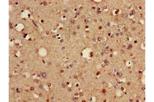 Immunohistochemistry of paraffin-embedded human brain tissue using ABIN7175463 at dilution of 1:100 (VTI1A 抗体  (AA 1-175))
