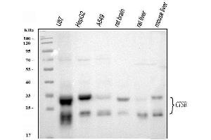 Western blot analysis of Cathepsin B/CTSB using anti-Cathepsin B/CTSB antibody (ABIN7601692).